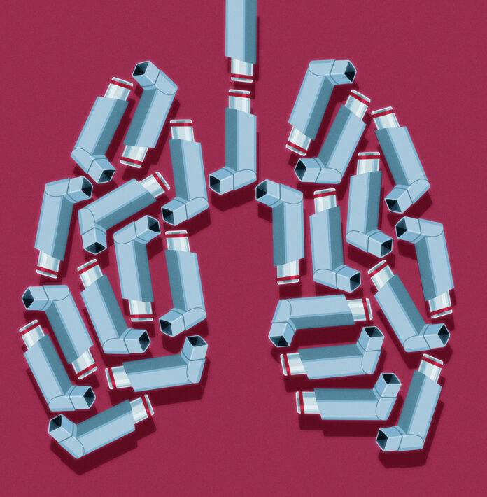 Breaking News: False Positive: Why Thousands of Patients May Not Have Asthma after All